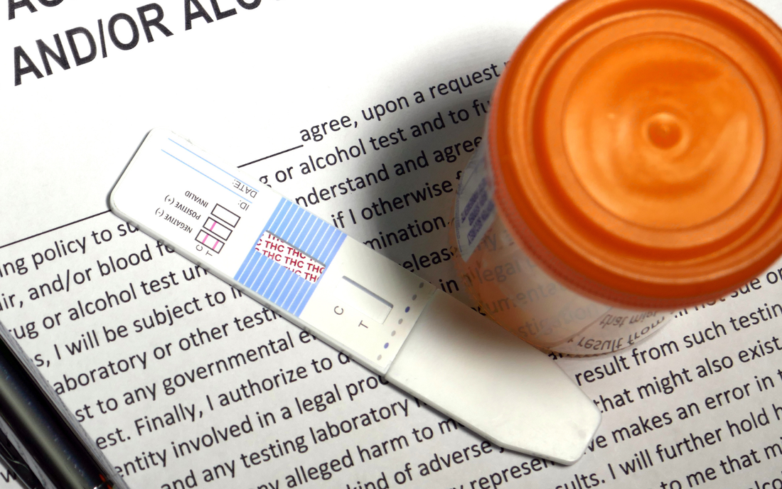 Overhead view of a urine drug test strip showing repeated “THC” text and an orange specimen cup resting on a signed drug testing consent form